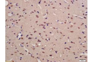 Formalin-fixed and paraffin embedded rat brain labeled with Rabbit Anti-TNIK (Ser769) Polyclonal Antibody, Unconjugated (ABIN711956) at 1:200 followed by conjugation to the secondary antibody and DAB staining (TNIK anticorps  (pSer769))