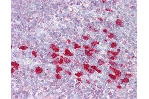 Anti-DLX5 antibody IHC of human thymus.