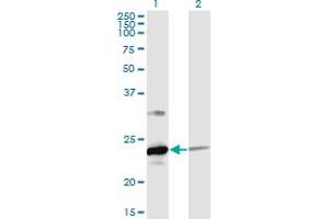 Western Blot analysis of UBE2T expression in transfected 293T cell line by UBE2T monoclonal antibody (M02), clone 4G1-4C2. (Ube2t anticorps  (AA 1-197))