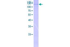 Image no. 1 for Sema Domain, Immunoglobulin Domain (Ig), Short Basic Domain, Secreted, (Semaphorin) 3C (SEMA3C) (AA 1-751) protein (GST tag) (ABIN7540267)