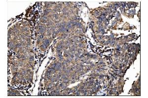 IHC analysis of AS160/TBC1D4 using anti-AS160/TBC1D4 antibody (ABIN7599745). (TBC1D4 anticorps  (AA 1118-1298))