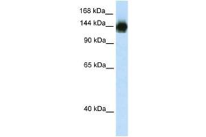 WB Suggested Anti-TIMELESS Antibody Titration:  2. (TIMELESS anticorps  (N-Term))