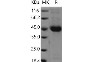 Western Blotting (WB) image for Poliovirus Receptor-Related 2 (Herpesvirus Entry Mediator B) (PVRL2) protein (His tag) (ABIN7321124)