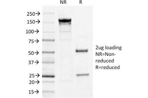 SDS-PAGE Analysis Purified IL3RA/CD123 Mouse Monoclonal Antibody (IL3RA/1531). (IL3RA anticorps  (AA 26-171))