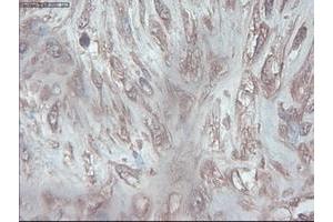 Image no. 1 for anti-Pancreatic and Duodenal Homeobox 1 (PDX1) antibody (ABIN1500144) (PDX1 anticorps)