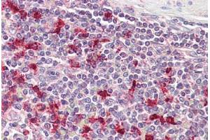 Anti-PTMA antibody IHC staining of human spleen. (PTMA anticorps  (AA 89-101))