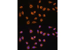 Immunofluorescence analysis of L929 cells using SLC20 antibody (ABIN1682754, ABIN3018562, ABIN3018563 and ABIN6220499) at dilution of 1:100.