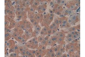 DAB staining on IHC-P; Samples: Human Liver Tissue (TOLLIP anticorps  (AA 28-261))