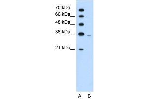 WB Suggested Anti-PRPS2  Antibody Titration: 1. (PRPS2 anticorps  (Middle Region))
