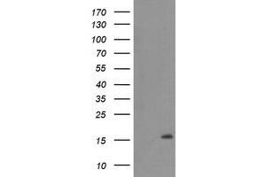 Western Blotting (WB) image for anti-Chromosome 20 Open Reading Frame 30 (C20orf30) antibody (ABIN1498766) (C20orf30 anticorps)