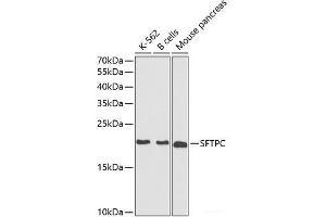 Western blot analysis of extracts of various cell lines using SFTPC Polyclonal Antibody at dilution of 1:1000. (Surfactant Protein C anticorps)