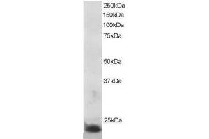 Image no. 1 for anti-Suppressor of Cytokine Signaling 3 (SOCS3) (C-Term) antibody (ABIN374066) (SOCS3 anticorps  (C-Term))