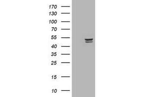 Image no. 3 for anti-Thymidine Phosphorylase (TYMP) (AA 311-482) antibody (ABIN1491394) (Thymidine Phosphorylase anticorps  (AA 311-482))