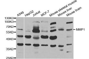 Western blot analysis of extracts of various cell lines, using MMP1 antibody. (MMP1 anticorps  (AA 20-280))