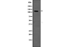 Western blot analysis of SLC12A2 expression in HEK293 cells ,The lane on the left is treated with the antigen-specific peptide. (SLC12A2 anticorps  (Internal Region))