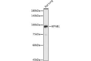 Western blot analysis of extracts of Rat lung, using KPNB1 antibody (ABIN6134722, ABIN6142997, ABIN6142998 and ABIN6224723) at 1:1000 dilution. (KPNB1 anticorps  (AA 250-350))