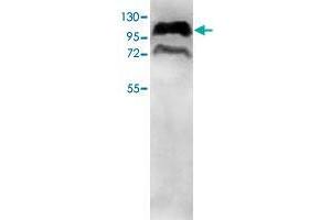 Western blot analysis of HepG2 cell lysate with PPP1R10 polyclonal antibody  at 1 : 500 dilution. (PPP1R10 anticorps  (AA 661-929))