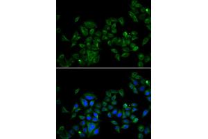 Immunofluorescence analysis of U2OS cell using MAGED1 antibody. (MAGED1 anticorps)