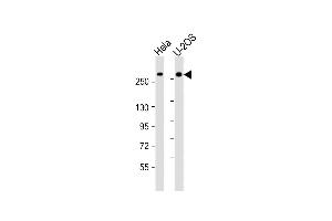 All lanes : Anti-FANCM Antibody (C-Term) at 1:2000 dilution Lane 1: Hela whole cell lysate Lane 2: U-2OS whole cell lysate Lysates/proteins at 20 μg per lane. (FANCM anticorps  (AA 1752-1783))