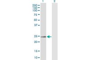 Western Blot analysis of RRAS expression in transfected 293T cell line by RRAS MaxPab polyclonal antibody.