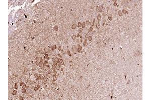 Paraformaldehyde-fixed, paraffin embedded Rat brain Antigen retrieval by boiling in sodium citrate buffer (pH6.