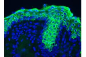 Image no. 3 for anti-Keratin 10 (KRT10) antibody (ABIN335328)