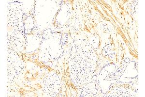 Immunohistochemistry (IHC) image for anti-Transglutaminase 4 (Prostate) (TGM4) (N-Term) antibody (ABIN2777148)