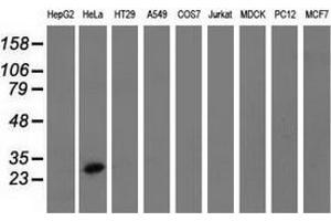 Western blot analysis of extracts (35 µg) from 9 different cell lines by using anti-GSTT2 monoclonal antibody. (GSTT2 anticorps)