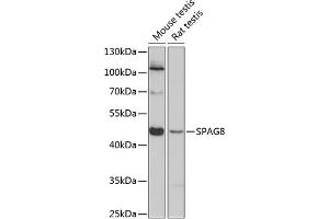 Western blot analysis of extracts of various cell lines, using SP antibody (ABIN6129712, ABIN6148323, ABIN6148324 and ABIN6224831) at 1:3000 dilution. (SPAG8 anticorps  (AA 220-420))