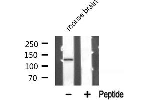 Western blot analysis of PKCB1 expression in Mouse brain lysate (ZMYND8 anticorps  (Internal Region))