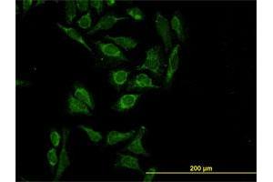 Immunofluorescence of monoclonal antibody to HTRA2 on HeLa cell. (HTRA2 anticorps  (AA 359-458))