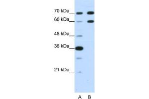 WB Suggested Anti-DMRT2 Antibody Titration:  1. (DMRT2 anticorps  (N-Term))