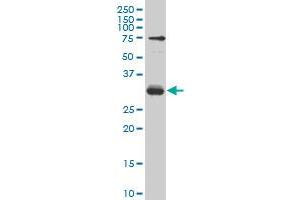TGIF2 monoclonal antibody (M04), clone 5G6 Western Blot analysis of TGIF2 expression in Hela S3 NE . (TGIF2 anticorps  (AA 131-236))