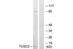 Western blot analysis of extracts from HeLa cells, using TUSC2 Antibody. (TUSC2 anticorps  (AA 41-90))
