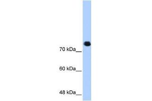WB Suggested Anti-SMC3 Antibody Titration:  0. (SMC3 anticorps  (C-Term))