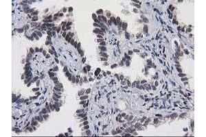 Image no. 1 for anti-Myocyte Enhancer Factor 2C (MEF2C) antibody (ABIN1499362)