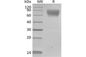 Western Blotting (WB) image for Trophoblast Glycoprotein (TPBG) protein (His tag,Biotin) (ABIN7319802)