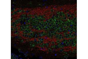 Indirect immunostaining of PFA fixed paraffin-embedded mouse hippocampus section with anti-SV 2C (dilution 1 : 200; red) and rabbit anti-sec 22b (, dilution 1 : 200; green). (SV2C anticorps  (AA 2-16))