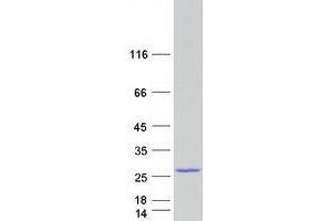 Validation with Western Blot