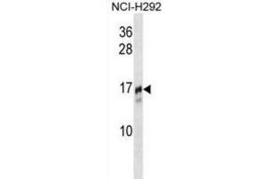 Western Blotting (WB) image for anti-Trafficking Protein Particle Complex 2 (TRAPPC2) antibody (ABIN2995169) (TRAPPC2 anticorps)