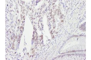 Immunohistochemistry (IHC) image for anti-Checkpoint Kinase 2 (CHEK2) (AA 475-525) antibody (ABIN7454369)