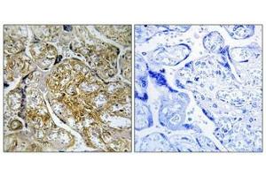 Immunohistochemical analysis of paraffin-embedded human placenta tissue using PAK1/2 (Phospho-Ser199) antibody (left)or the same antibody preincubated with blocking peptide (right).