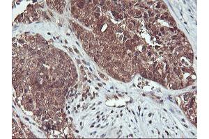 Image no. 4 for anti-Haloacid Dehalogenase-Like Hydrolase Domain Containing 1 (HDHD1) antibody (ABIN1498625) (HDHD1 anticorps)