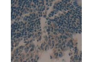 IHC-P analysis of Human Tissue, with DAB staining. (CCL21 anticorps  (AA 24-134))