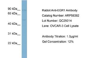 WB Suggested Anti-EGR1  Antibody Titration: 0. (EGR1 anticorps  (Middle Region))
