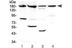 Western blot testing of 1) human PANC-1, 2) human placenta, 3) rat kidney and 4) mouse kidney lysate with ERBB4 antibody at 0. (ERBB4 anticorps)
