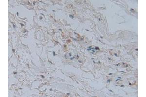 Used in DAB staining on fromalin fixed paraffin-embedded heart tissue (GLRX3 anticorps  (AA 144-234))