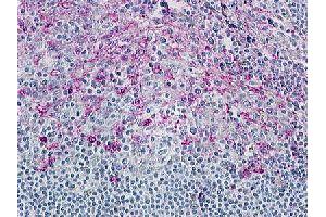 Immunohistochemical (Formalin/PFA-fixed paraffin-embedded sections) staining in human tonsil with CCR8 polyclonal antibody . (CCR8 anticorps  (3rd Cytoplasmic Domain))