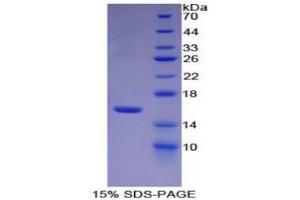 SDS-PAGE of Protein Standard from the Kit (Highly purified E.