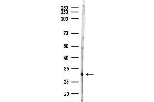 anti-Carbonyl Reductase 3 (CBR3) (C-Term) antibody